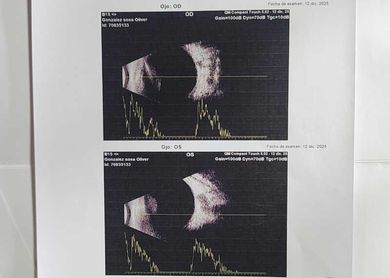 Campaña solidaria para operar de urgencia a un bebé con cataratas congénitas en Posadas 5 WhatsApp Image 2026 01 08 at 09.19.03